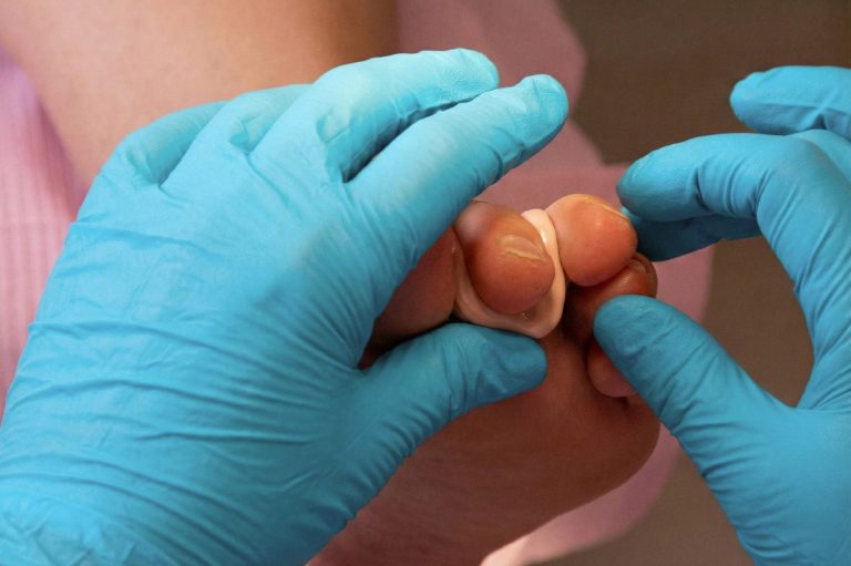 Eine Podologin mit medizinischen Handschuhen behandelt einen Zeh mit einem Verband.
